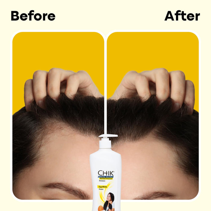 Chik Protein Solution Hairfall Prevent Shampoo, 340 ml | With Goodness Of Egg White, For Thick And Healthier Hair