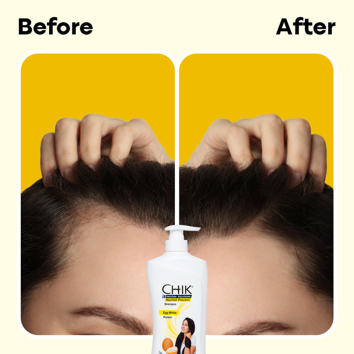 Chik Protein Solution Hairfall Prevent Shampoo, 650 ml | With Goodness Of Egg White, For Thick And Healthier Hair